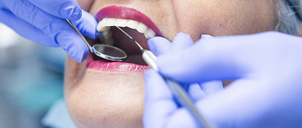 Best Emergency Dental Extractions in Franklin, NC